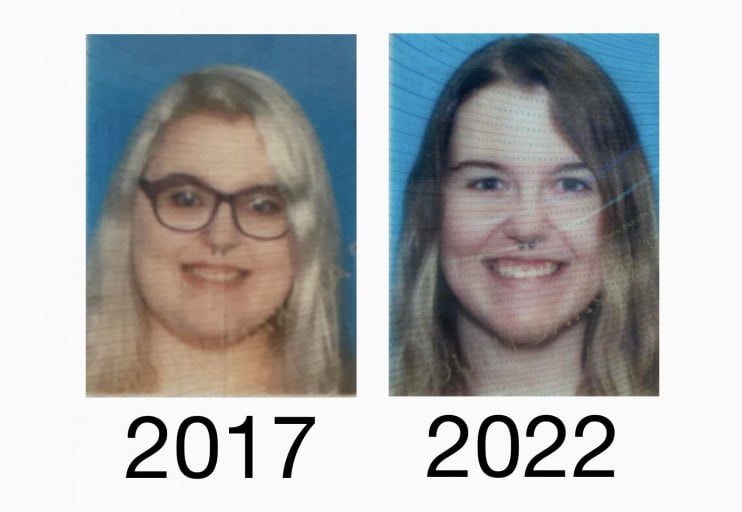A picture of a 5'6" female showing a weight loss from 332 pounds to 195 pounds. A net loss of 137 pounds.