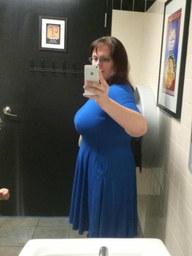 A picture of a 5'4" female showing a weight cut from 280 pounds to 180 pounds. A net loss of 100 pounds.