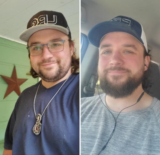 A before and after photo of a 6'2" male showing a weight reduction from 285 pounds to 260 pounds. A respectable loss of 25 pounds.