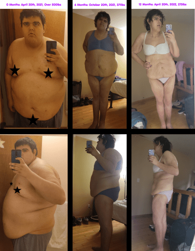 225 lbs Weight Loss Before and After 6 foot 2 Female 500 lbs to 275 lbs