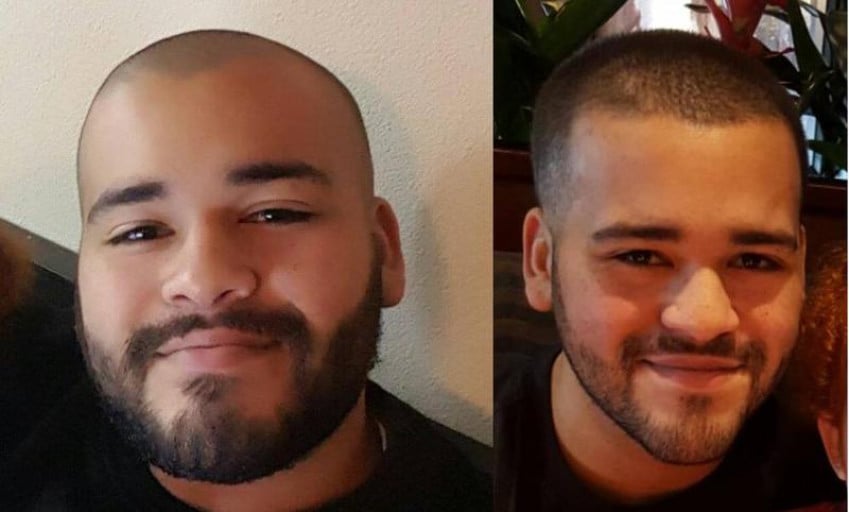 How a Reddit User Lost 46Lbs in 3 Months for Facial Gains