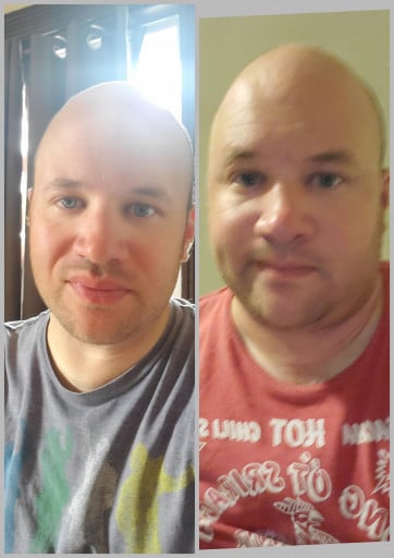 A progress pic of a 5'7" man showing a fat loss from 210 pounds to 180 pounds. A respectable loss of 30 pounds.