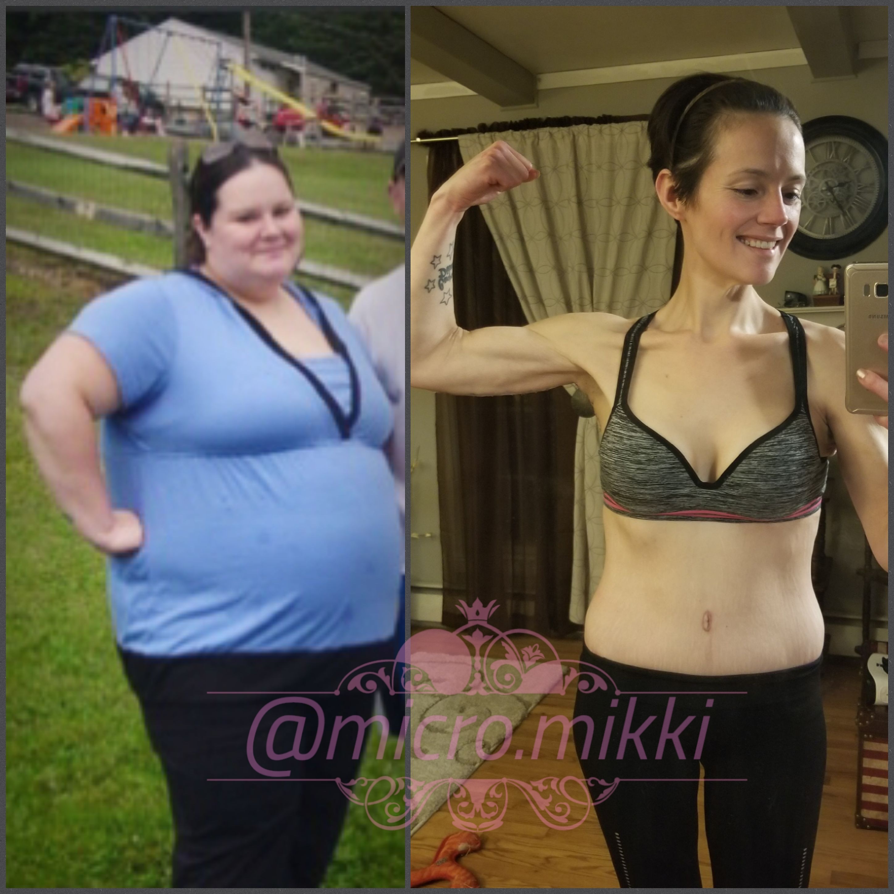279 lbs Fat Loss 5 feet 6 Female 399 lbs to 120 lbs
