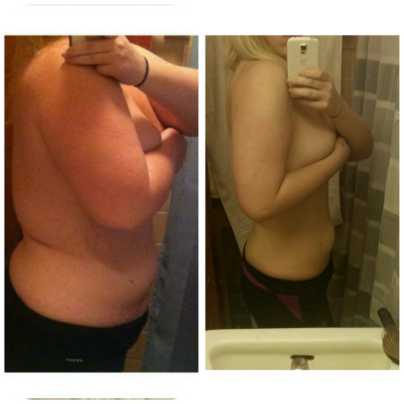 5 feet 8 Female Before and After 78 lbs Fat Loss 275 lbs to 197 lbs