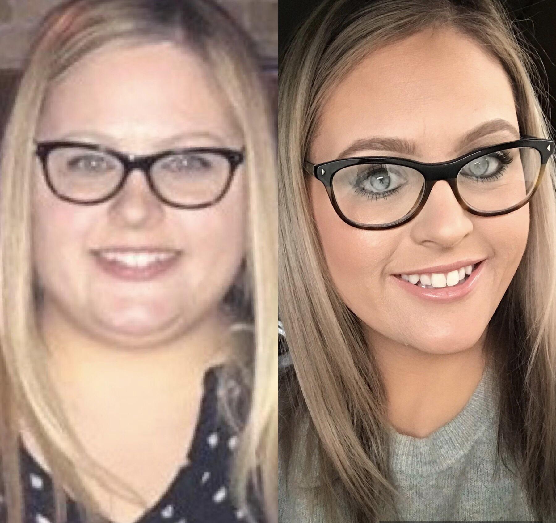5'7 Female Progress Pics of 102 lbs Weight Loss 305 lbs to 203 lbs