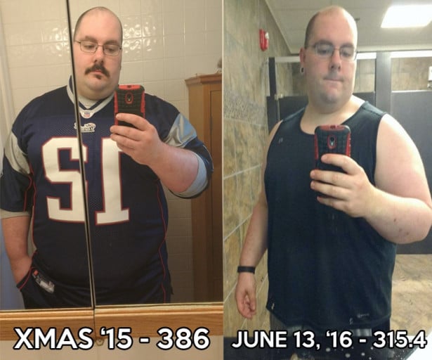 A photo of a 5'11" man showing a weight loss from 386 pounds to 315 pounds. A respectable loss of 71 pounds.
