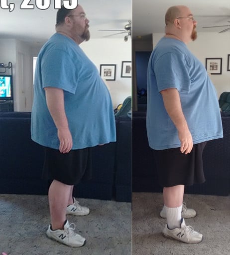 A picture of a 5'10" male showing a weight loss from 499 pounds to 412 pounds. A total loss of 87 pounds.