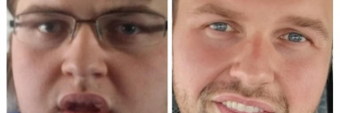 160 lbs Weight Loss Before and After 6'5 Male 420 lbs to 260 lbs