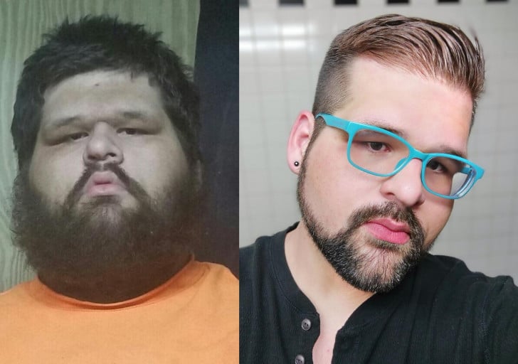A picture of a 5'11" male showing a weight loss from 605 pounds to 329 pounds. A respectable loss of 276 pounds.