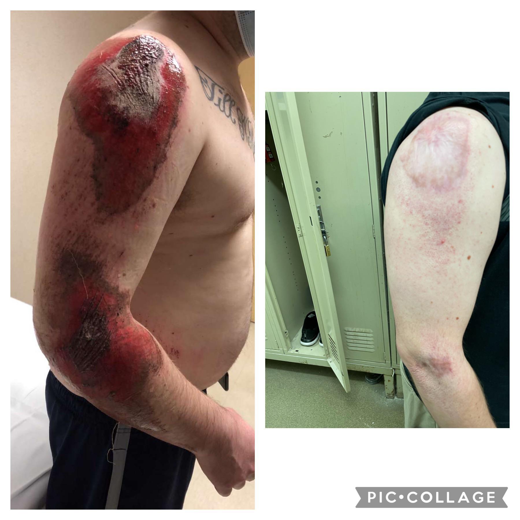 Progress Pics of 4 lbs Weight Loss 5 foot 5 Male 176 lbs to 172 lbs