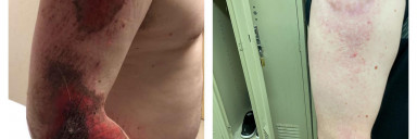 5 feet 5 Male Before and After 4 lbs Weight Loss 176 lbs to 172 lbs