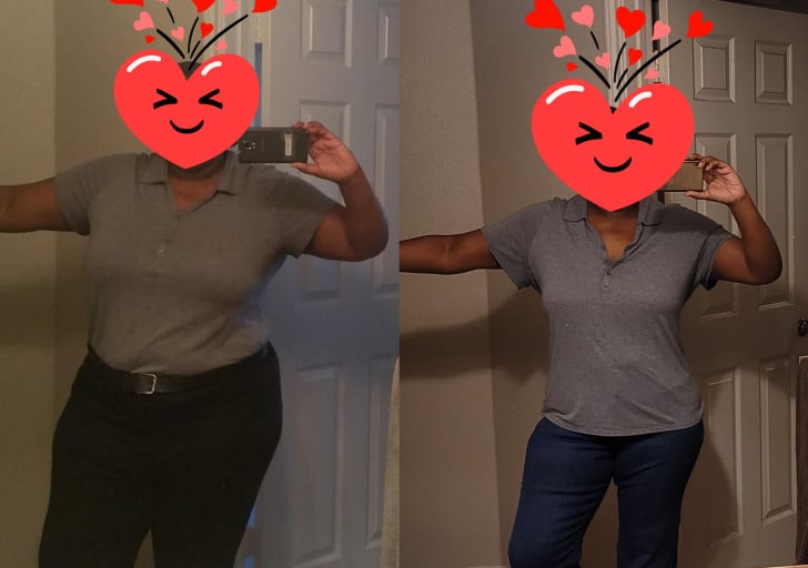 A before and after photo of a 5'8" female showing a weight reduction from 315 pounds to 227 pounds. A net loss of 88 pounds.