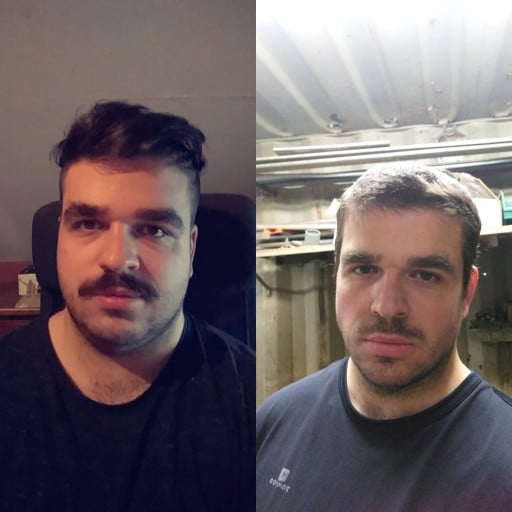A before and after photo of a 5'11" male showing a weight reduction from 297 pounds to 210 pounds. A net loss of 87 pounds.