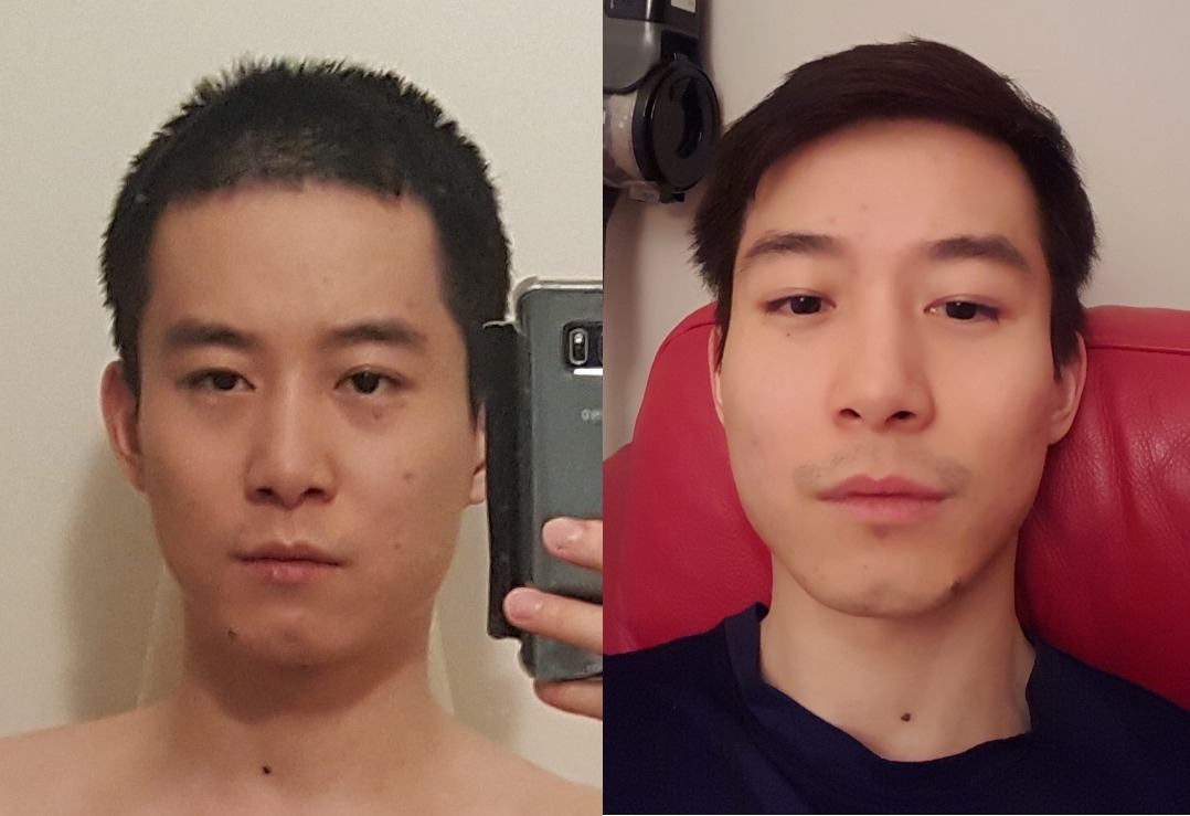 8 lbs Fat Loss Before and After 5'8 Male 149 lbs to 141 lbs