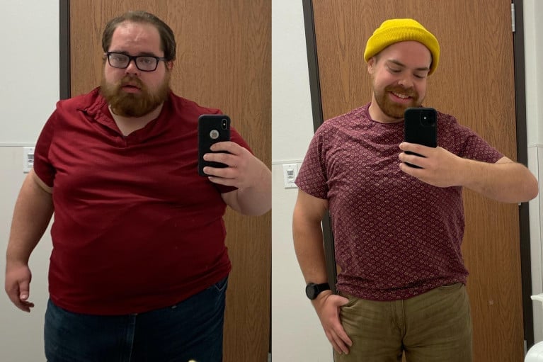 A picture of a 5'9" male showing a weight loss from 375 pounds to 200 pounds. A respectable loss of 175 pounds.