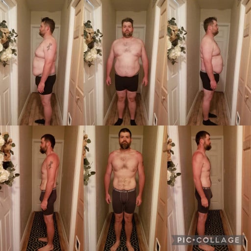 A before and after photo of a 6'4" male showing a weight reduction from 329 pounds to 228 pounds. A net loss of 101 pounds.