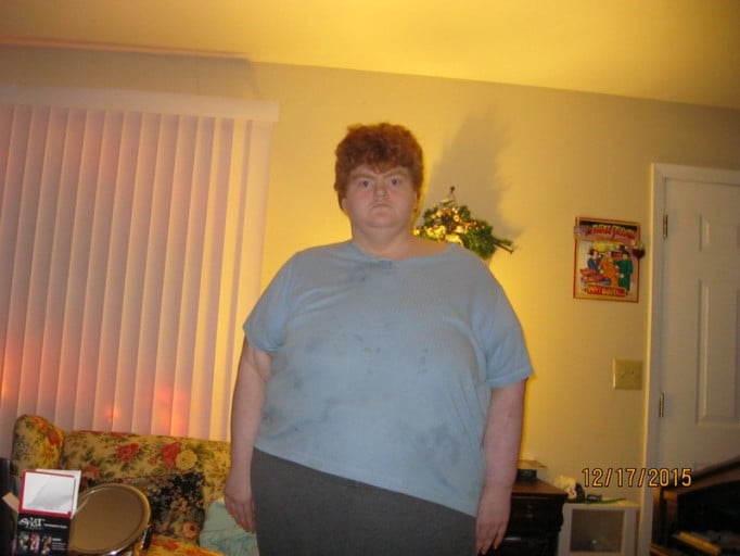 A before and after photo of a 5'5" female showing a weight cut from 450 pounds to 383 pounds. A total loss of 67 pounds.