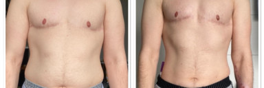 5'7 Male Before and After 23 lbs Fat Loss 177 lbs to 154 lbs
