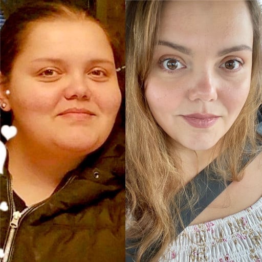 5'7 Female Progress Pics of 125 lbs Weight Loss 339 lbs to 214 lbs