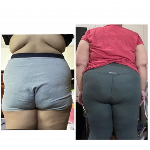 A before and after photo of a 5'4" female showing a weight reduction from 310 pounds to 232 pounds. A net loss of 78 pounds.