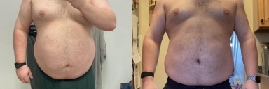 5'9 Male 60 lbs Weight Loss Before and After 305 lbs to 245 lbs