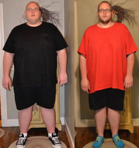 A picture of a 6'7" male showing a weight reduction from 525 pounds to 397 pounds. A respectable loss of 128 pounds.