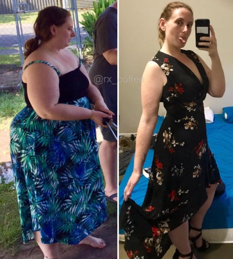 5 feet 9 Female 156 lbs Fat Loss Before and After 320 lbs to 164 lbs