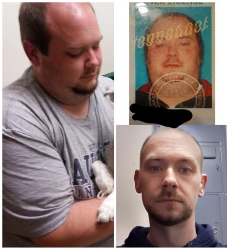 A before and after photo of a 6'0" male showing a weight reduction from 329 pounds to 180 pounds. A total loss of 149 pounds.