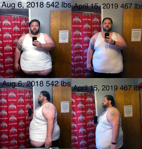 A before and after photo of a 6'1" male showing a weight reduction from 542 pounds to 467 pounds. A respectable loss of 75 pounds.