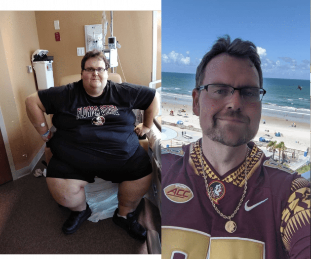 Progress Pics of 342 lbs Fat Loss 6 foot Male 587 lbs to 245 lbs