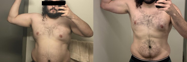 6 foot Male 82 lbs Weight Loss 312 lbs to 230 lbs