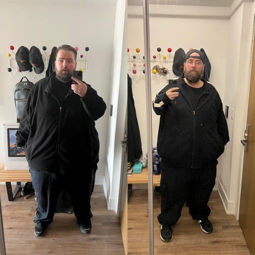 A before and after photo of a 6'1" male showing a weight reduction from 520 pounds to 140 pounds. A total loss of 380 pounds.