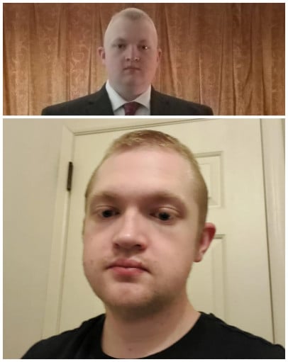5'8 Male 81 lbs Weight Loss Before and After 270 lbs to 189 lbs