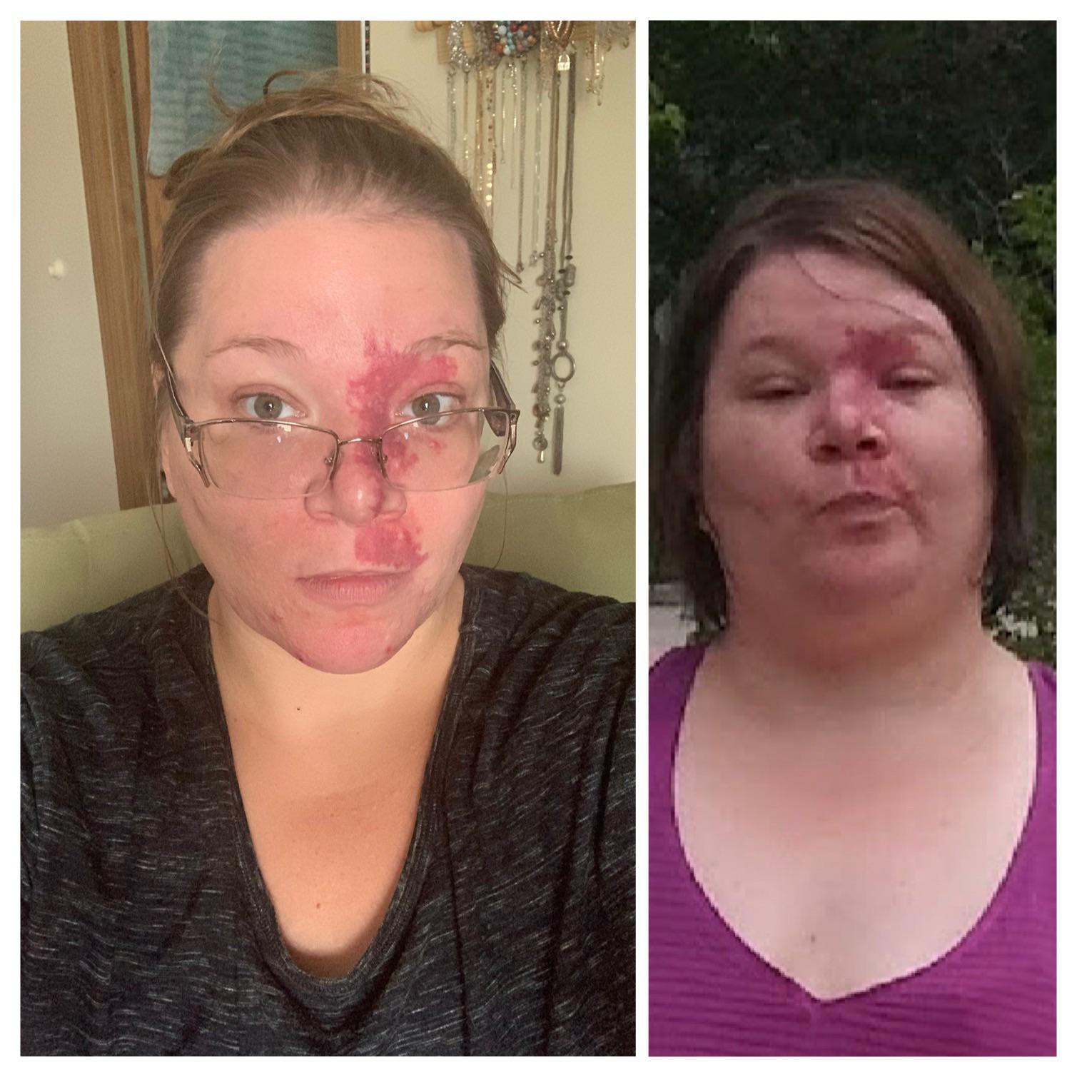 5 feet 7 Female 107 lbs Weight Loss 366 lbs to 259 lbs