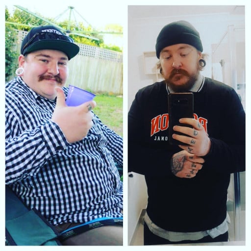 A before and after photo of a 5'11" male showing a weight reduction from 310 pounds to 238 pounds. A respectable loss of 72 pounds.