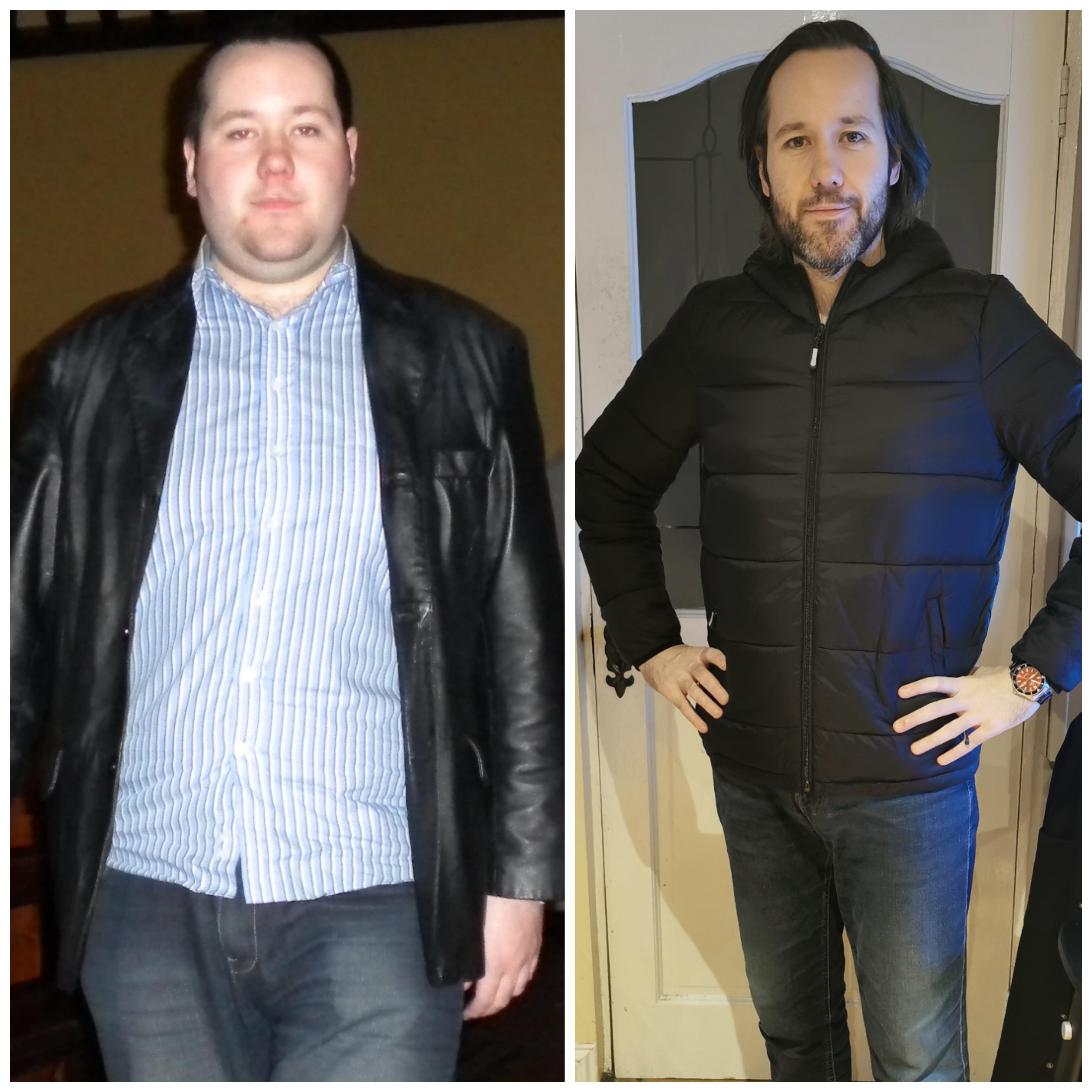 6 feet 2 Male Progress Pics of 120 lbs Weight Loss 305 lbs to 185 lbs