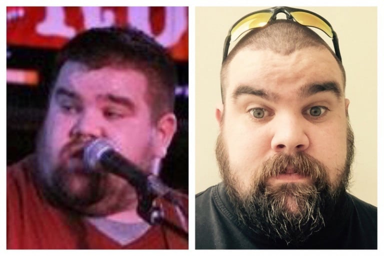 A progress pic of a 5'9" man showing a fat loss from 380 pounds to 311 pounds. A net loss of 69 pounds.