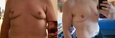 Progress Pics of 58 lbs Weight Loss 6 foot Male 265 lbs to 207 lbs