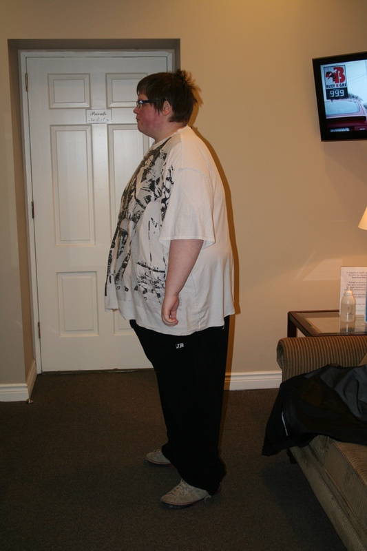 6 feet 3 Male 189 lbs Weight Loss 419 lbs to 230 lbs