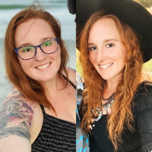F/29/5’6 [202<145=57] it’s always the facial pictures that make me realize how far I’ve came. In two years my life has changed completely.