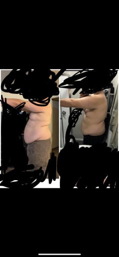 A before and after photo of a 5'10" male showing a weight reduction from 308 pounds to 271 pounds. A net loss of 37 pounds.
