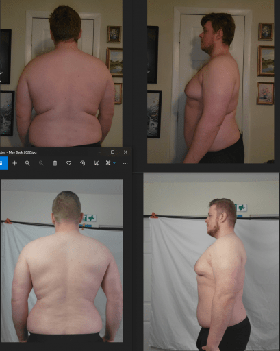 A before and after photo of a 6'4" male showing a snapshot of 310 pounds at a height of 6'4