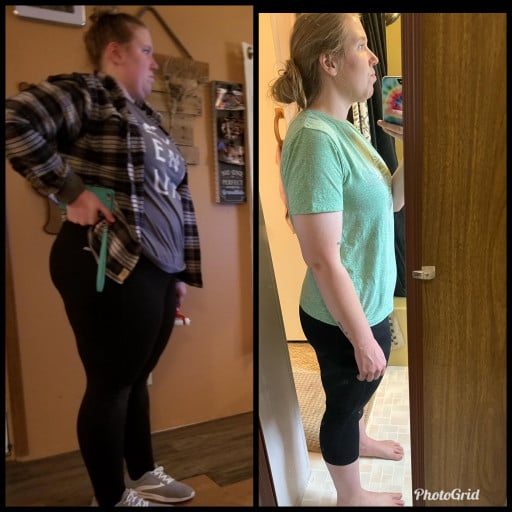 5 foot 7 Female 195 lbs Fat Loss Before and After 310 lbs to 115 lbs