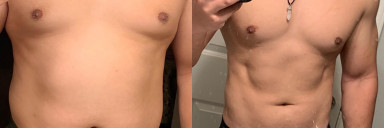 5'10 Male Progress Pics of 36 lbs Weight Loss 225 lbs to 189 lbs
