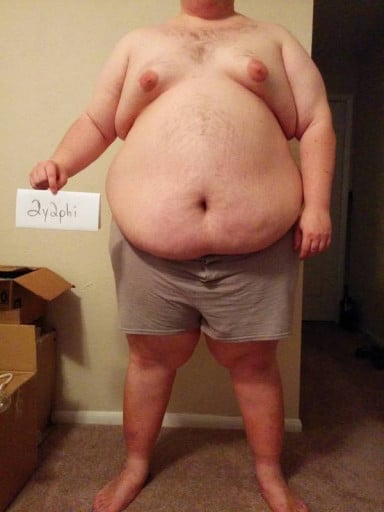 A progress pic of a person at 404 lbs