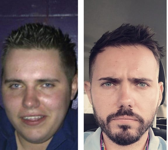 M/30/6'0 [321Lbs > 210Lbs = 111Lbs] (2 Years) a Male Weight Loss Transformation Story!