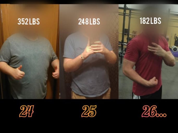 5 foot 11 Male 170 lbs Weight Loss Before and After 352 lbs to 182 lbs