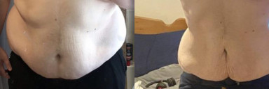6'3 Male Before and After 135 lbs Fat Loss 370 lbs to 235 lbs