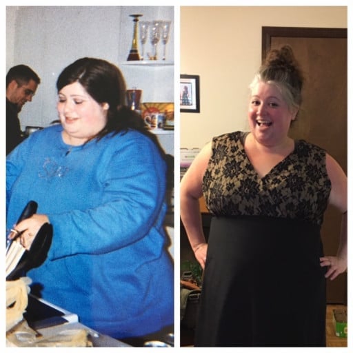 A before and after photo of a 5'5" female showing a weight reduction from 390 pounds to 265 pounds. A total loss of 125 pounds.