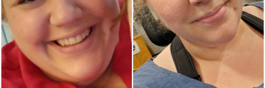 75 lbs Weight Loss Before and After 5 feet 7 Female 325 lbs to 250 lbs